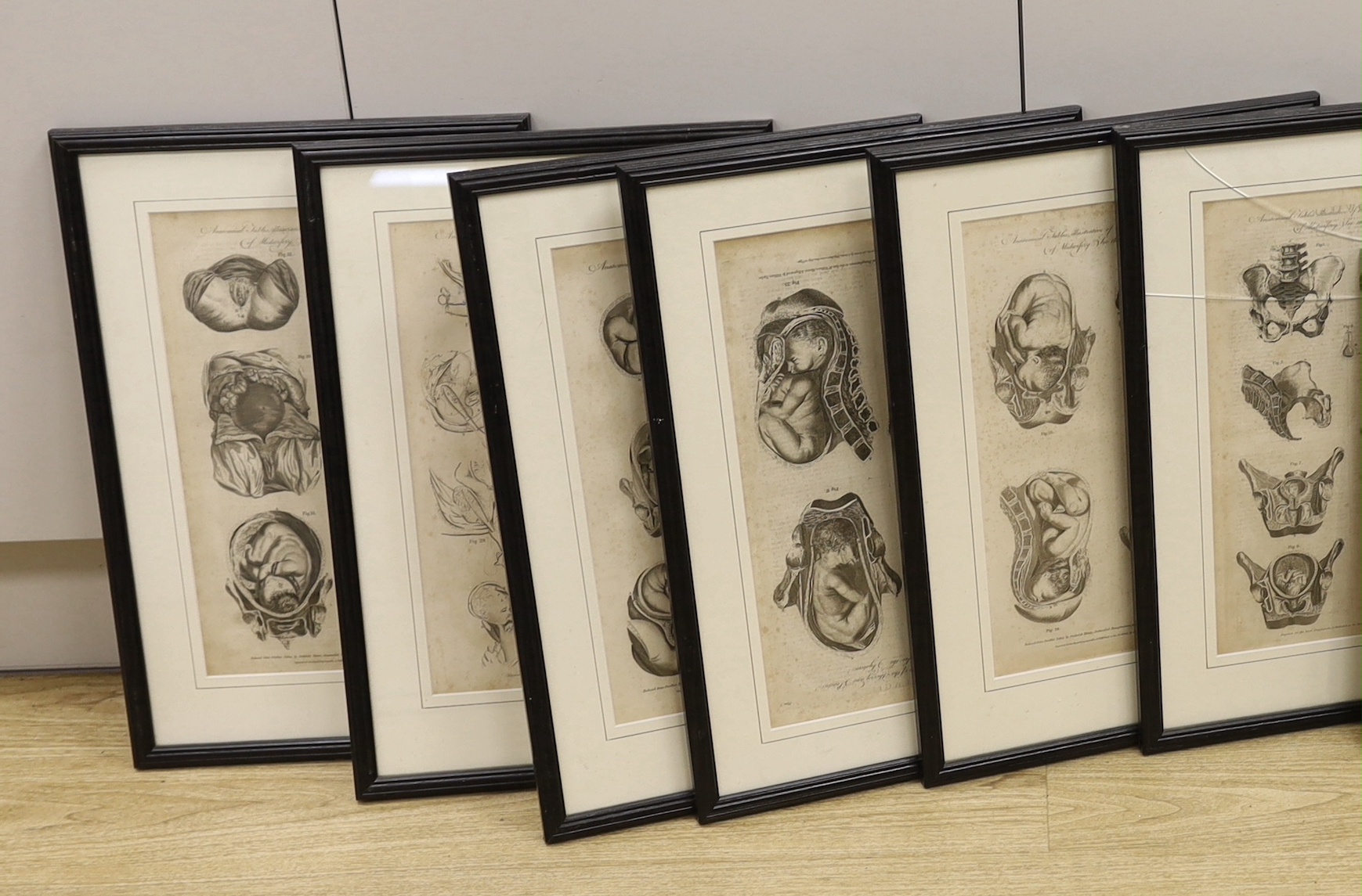 A set of eight medical and anatomical 18th century engravings, illustrating the theory and practice of midwifery, engraved for The Royal Encyclopedia and published as the Act Directs by C. Cooke, each 36 x 22cm
